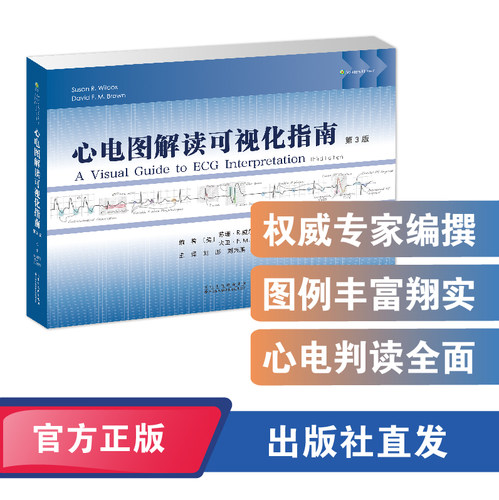 心电图解读可视化指南