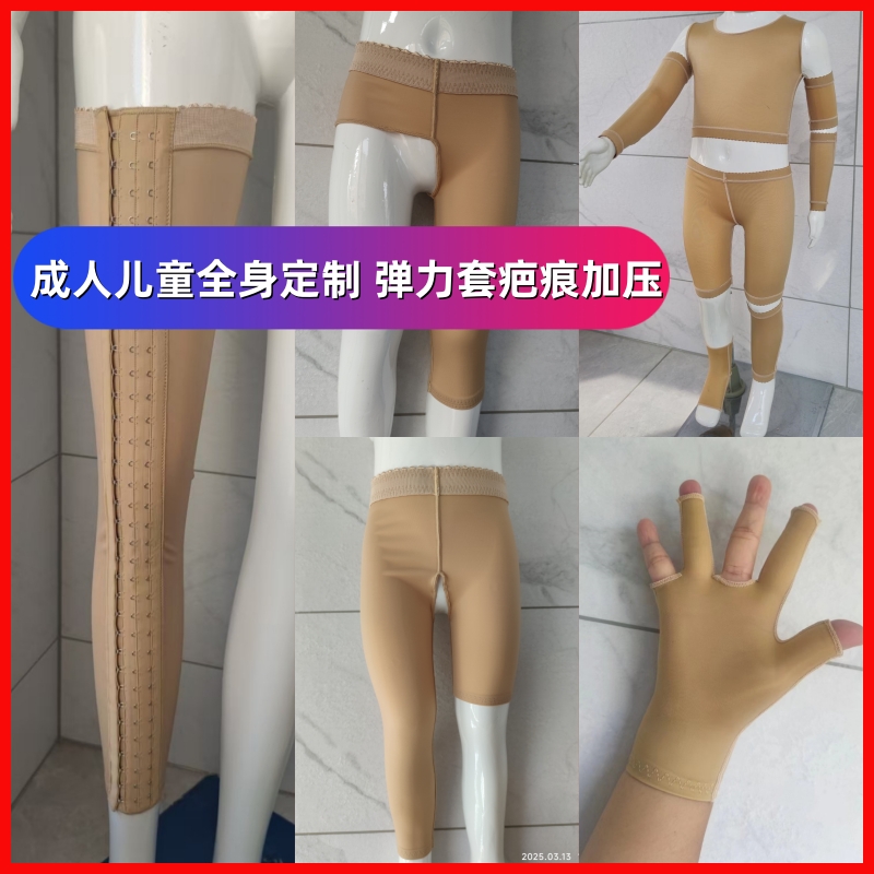 定制疤痕弹力套加压手指儿童烧伤烫伤膝盖大腿手套手臂防增生
