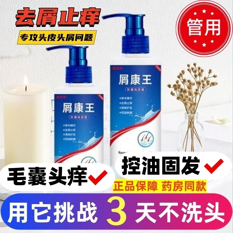 屑康王头皮癣脂溢性皮炎控油去屑