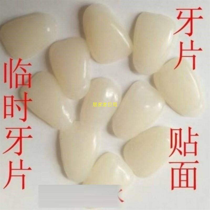 临时牙贴片牙贴面牙片牙齿发黑牙片烤瓷牙脱落超薄