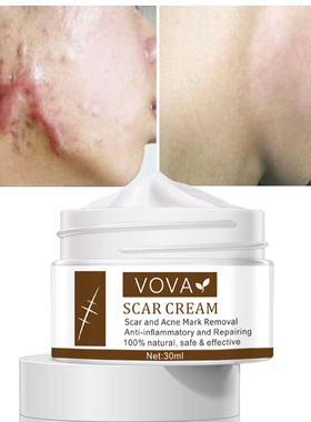 跨境vova Ance Scar  Cream 速卖通 亚马逊护肤品 30ml