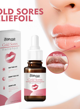 EELHOE 唇护理油 淡化唇纹修护唇周颗粒防干裂干燥滋润唇部护理油