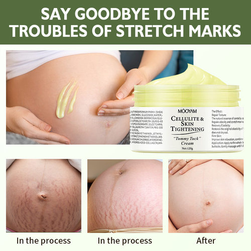 stretch mark cream肥胖身体纹护理霜紧致滋养淡化产后孕纹修护霜