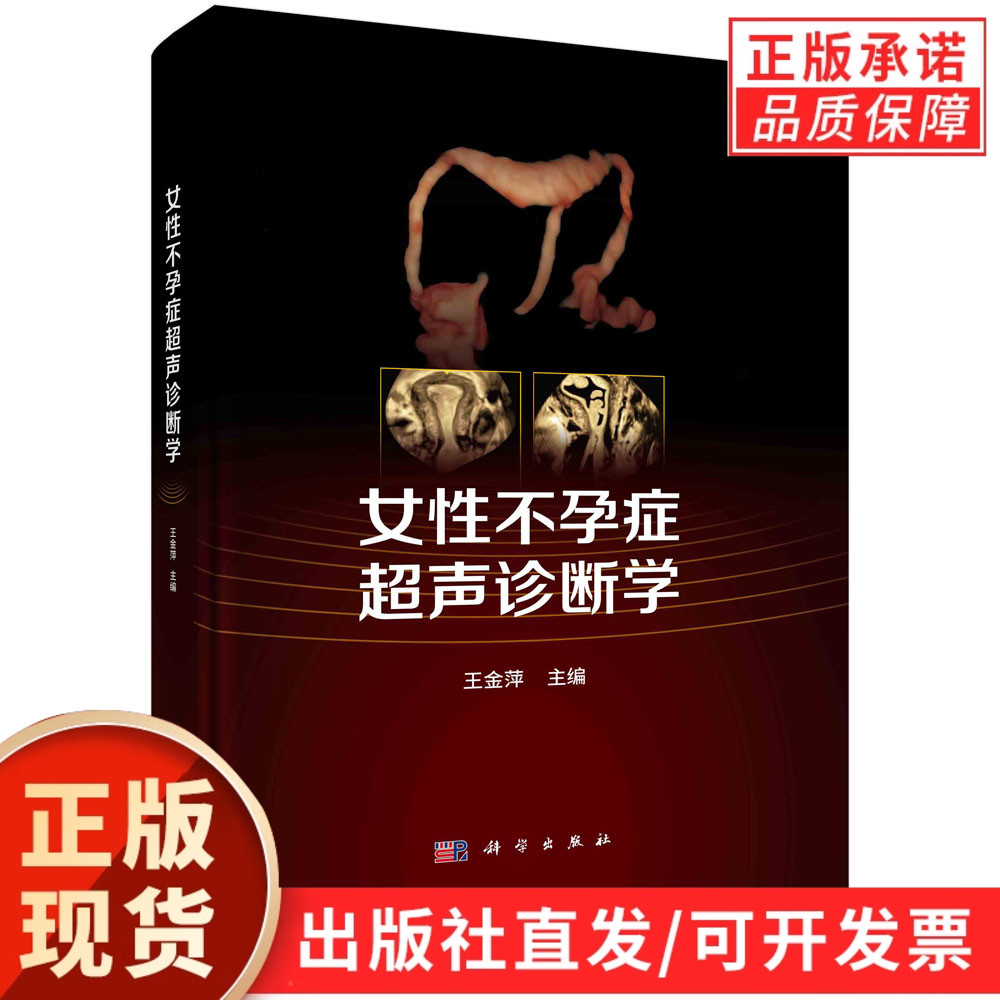 女性不孕症超声诊断学/王金萍