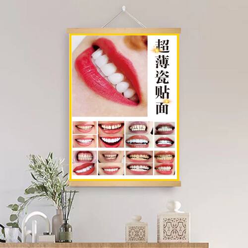 美牙广告图口腔美容装饰画炫齿面挂画牙齿美白图片瓷贴面宣传挂轴