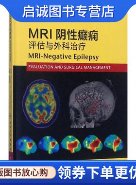 正版现货直发MRI阴性癫痫评估与外科治疗 Elson L.So,Philippe Ryvlin 编,赵国光 译 9787117247153 人民卫生出版社