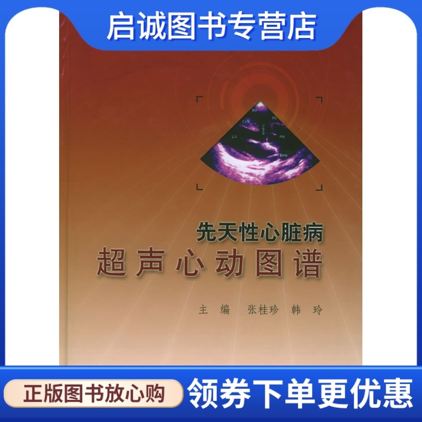 先天性心脏病超声心动图谱 张桂珍,韩玲  主编 人民卫生出版社
