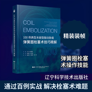 100例典型未破裂脑动脉瘤弹簧圈栓塞术技巧精解内科生活辽宁科学技术出版社