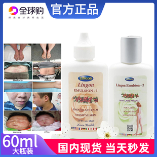 正品秒发Lingon Emulsion 林刚大瓶60ml 1号2号皮癣瘙痒皮疹皮炎