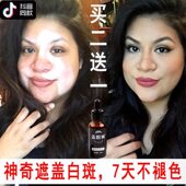 防水持久肤色白癜風遮盖笔外用白班促品牌 盖脱林白斑遮盖液