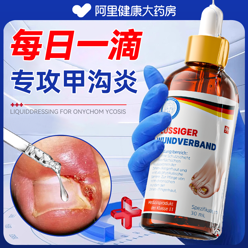甲沟炎医用灰指甲嵌甲专用矫正软化剂治息肉去除膏消肿化脓疗抑菌