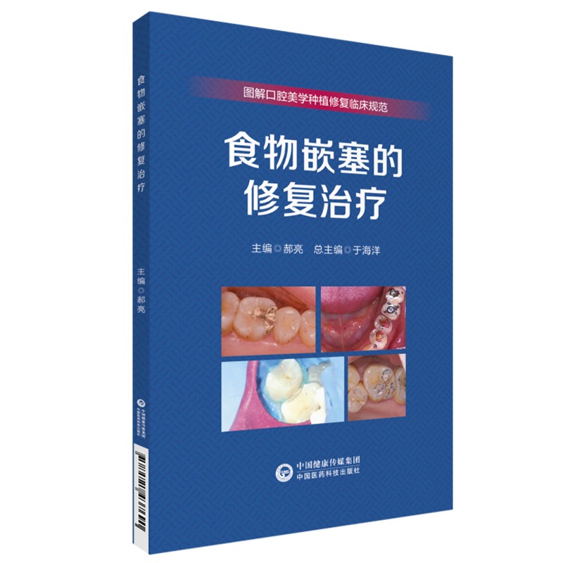 食物嵌塞的修复治疗 图解口腔美学种植修复临床规范 于海洋主编供各