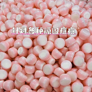 清颜宝特效痘痘膏祛闭口粉刺痤疮 男女学生青春痘 淡化痘印