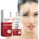 Skin Retinol Softening Nourishing Moisturising Serum Facial