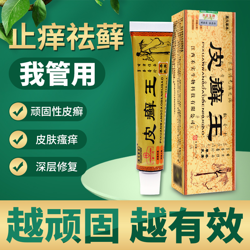 皮癣王乳膏癣膏银屑癣顽固性皮藓毛囊炎药膏头部皮肤外用软膏zj
