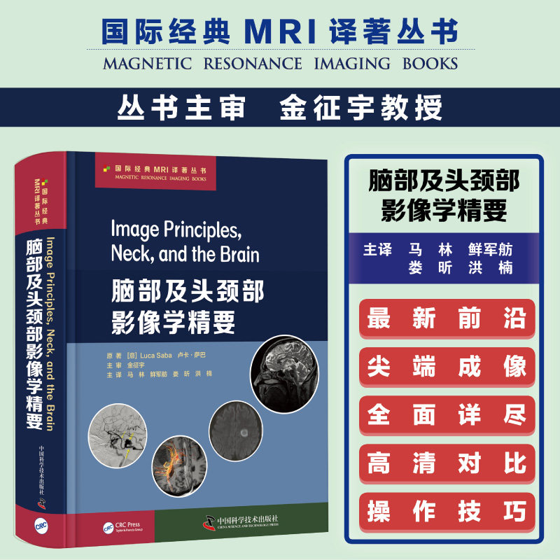 脑部及头颈部影像学精要:附成像原理与基础 国际经典MRI译著丛书 Luca Saba教授编著影像医学书籍西医精装书