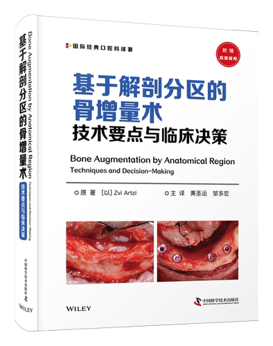 基于解剖分区的骨增量术：技术要点与临床决策享誉全球/直面问题/简化技巧/临床决策/避免并发症