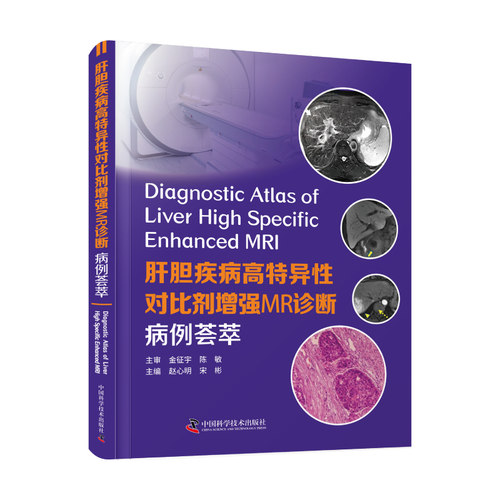 肝胆疾病高特异性对比剂增强MR诊断:病例荟萃 国内多位著名影像学专家联合编写本书 赵心明宋彬主编