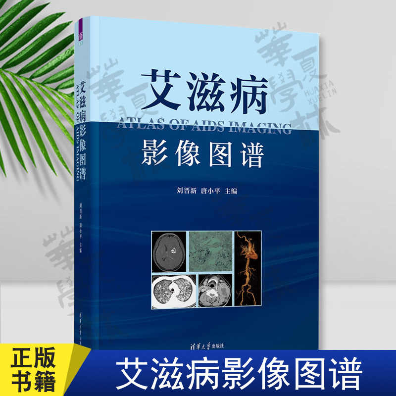 艾滋病影像图谱清华大学出版社