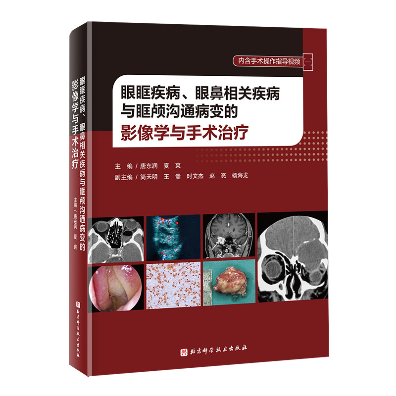 眼眶疾病、眼鼻相关疾病与眶颅沟通病变的影像学与手术治疗 医学 影响 眼科 耳鼻喉科 神经外科参考书 北京科学技术