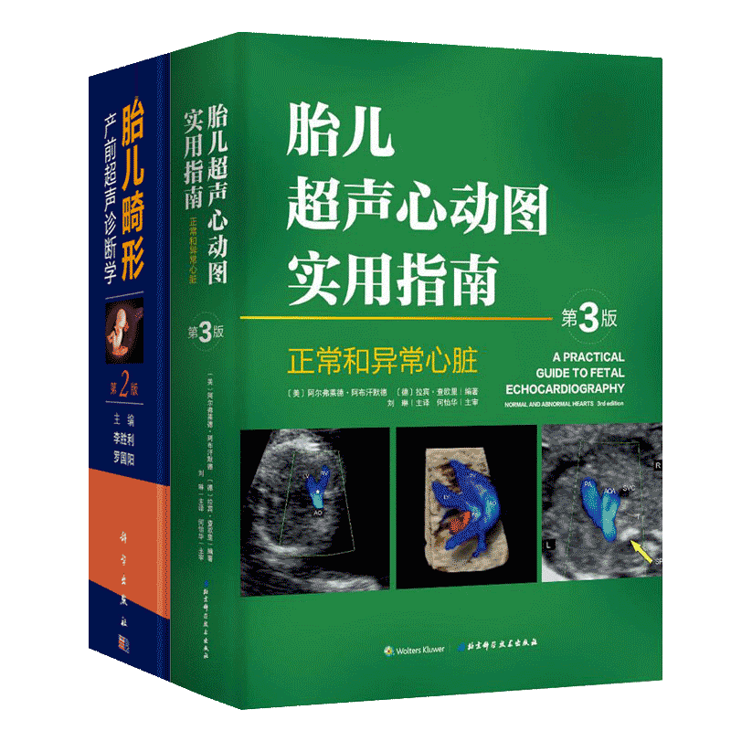胎儿超声心动图实用指南 胎儿畸形产前超声诊断学第二2版临床书超声