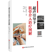 后藤英之 北京科学技术出版 主编 临床运动系统局部麻醉 社 注射技术操作关节外组织注射 超声引导下肌骨介入治疗图解