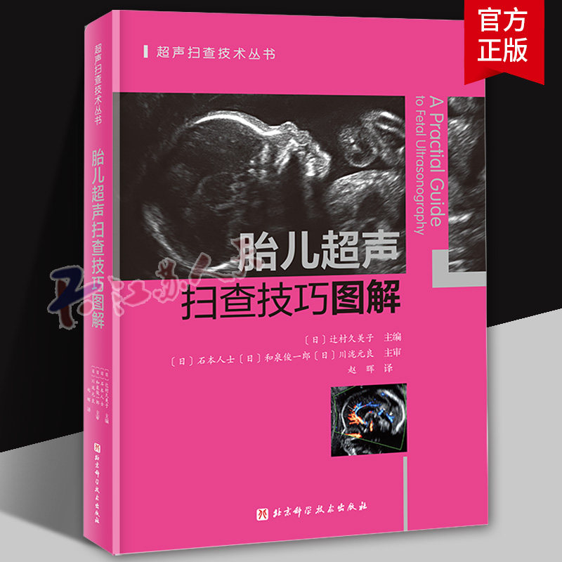 胎儿超声扫查技巧图解 辻村久美子 产科超声医生的黄金操作法典 覆盖ISUOG孕期筛查全路径 北京科学技术出版社