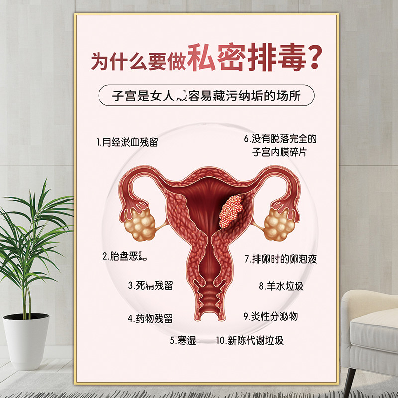 私密海报宣传子宫排毒图片产后护理画妇科挂画私密房间装饰广告图