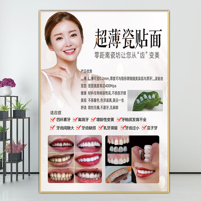 瓷贴面广告图全瓷牙贴面图片牙齿美白贴片挂画纳米牙美牙宣传海报
