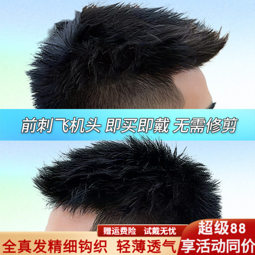 假发男头顶补发前刺男士