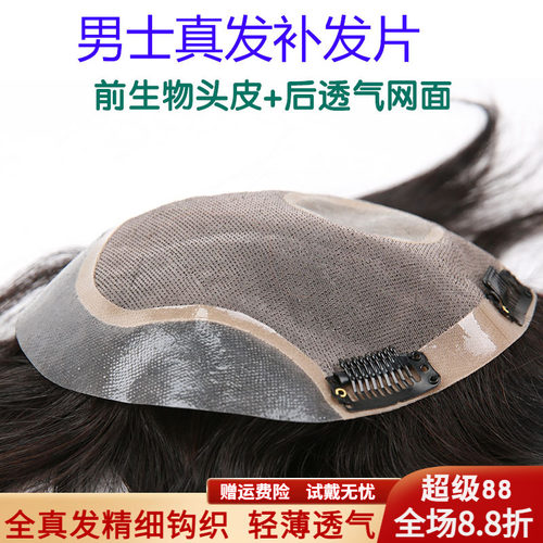 假发头顶帅气男士前额隐形