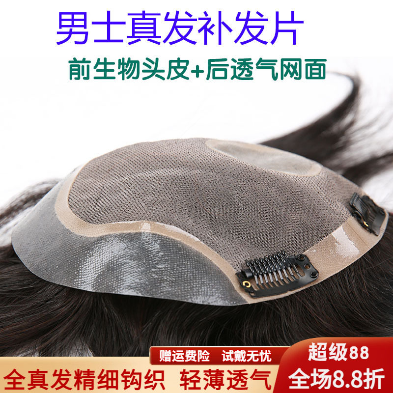 假发男头顶补发男真发短发帅气织发补发片男士秃顶前额发际线隐形