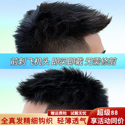 假发男头顶补发前刺男士