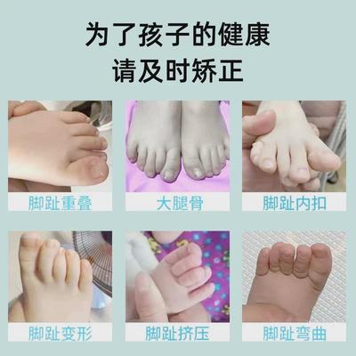 宝宝脚趾矫正器儿童婴儿分趾器拇指外翻弯曲内扣小脚趾内翻分离器