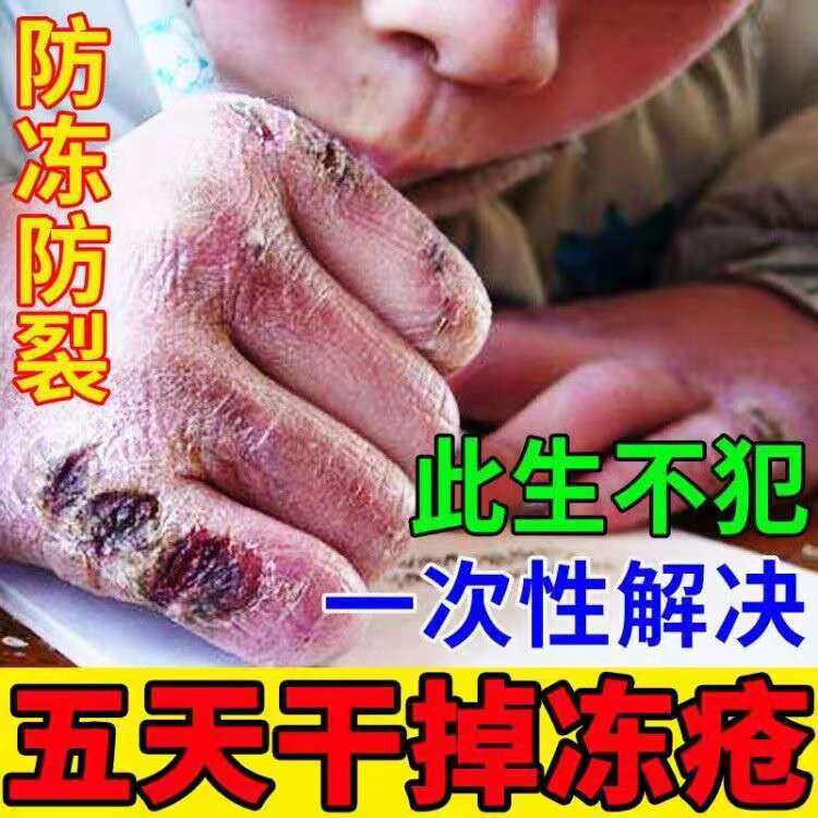 冻疮膏消肿止痒冻伤膏治根正品防冻裂修复儿童宝宝冻手部耳朵脸脚