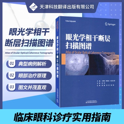 眼光学相干断层扫描图谱 新型层析成像技术OCT技术 眼科疾病诊疗病理性近视遗传性疾病炎性疾病眼科常见疾病