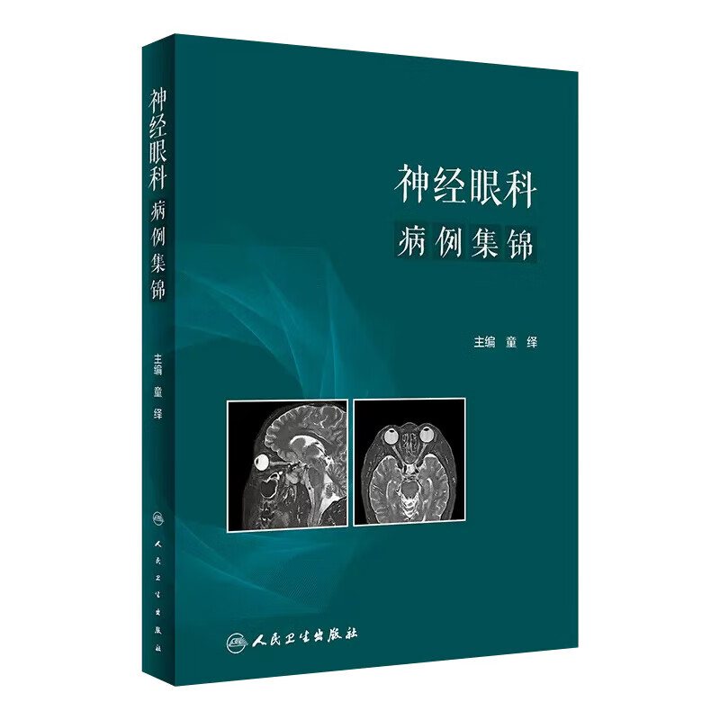 神经眼科病例集锦 眼球运动异常和相关斜视 后天性展神经麻痹 明确对疾病的正确诊断 病例加以述评 多幅眼底图及影像学图谱指南