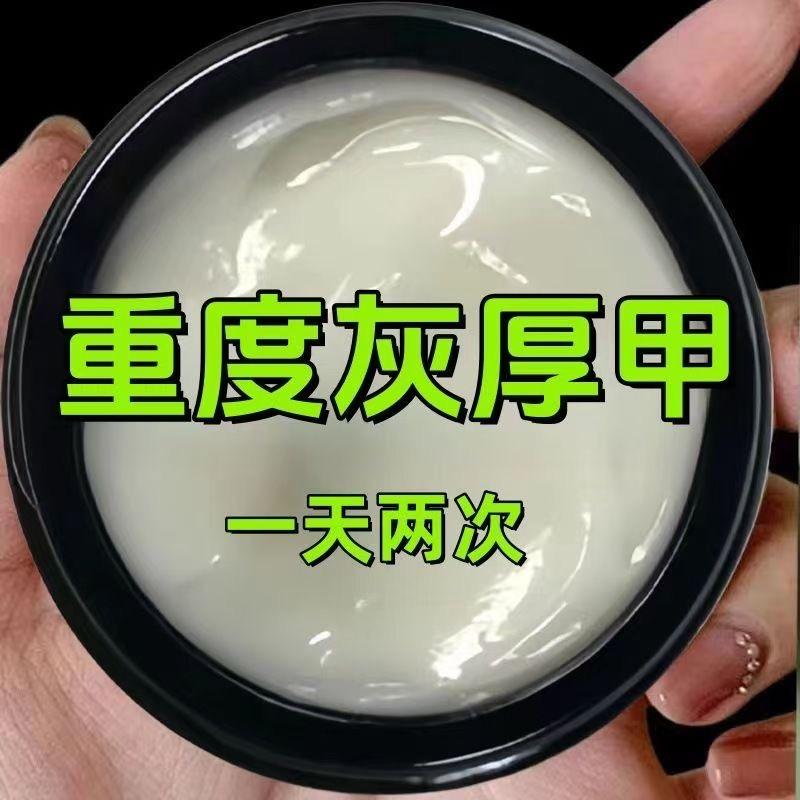 脚指甲增厚灰指甲专用药膏灰甲净