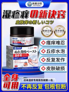 氟芬那酸丁酯软膏湿止痒疹外用根顽固慢性皮炎膏草本拔疹灵全身痒