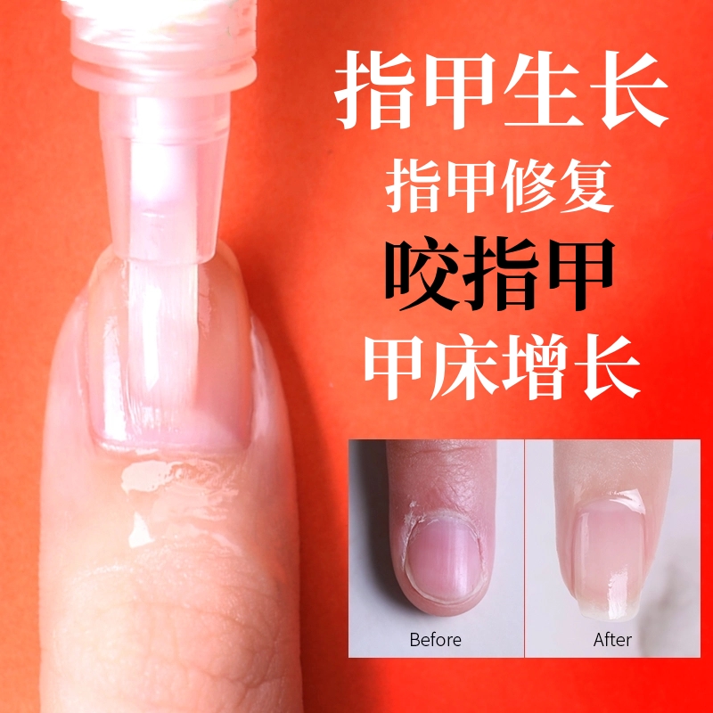 指甲增長修復液啃指甲甲床增長液