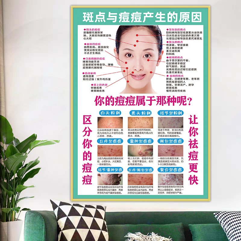 祛斑祛痘海报痘的原因分类广告痤疮粉刺美容院专业面部祛斑宣传画