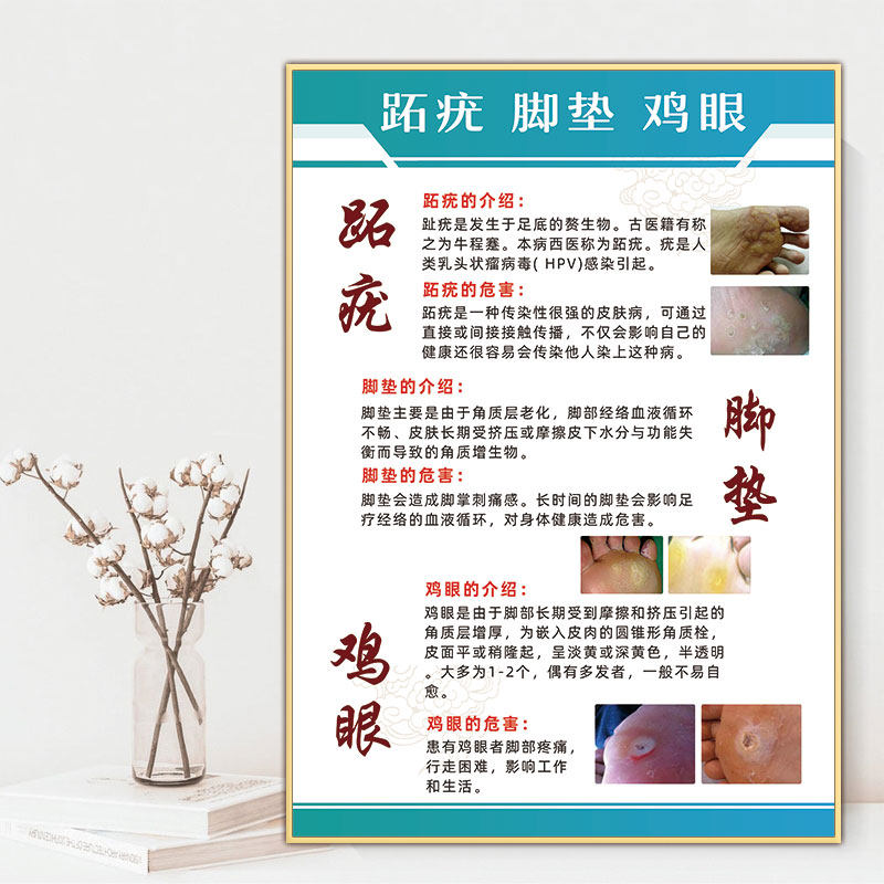 脚病图灰指甲广告图修脚海报跖疣脚垫宣传画足疗店装饰画鸡眼挂图
