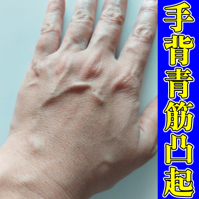 手背青筋凸起手部血管暴起手上有青筋静脉青筋凸起软膏