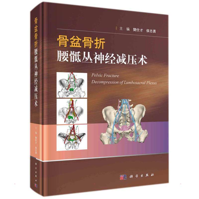 骨盆骨折腰骶丛神经减压术樊仕才普通大众骨盆骨折诊疗腰骶部周围神经系统医药卫生书籍