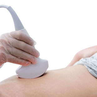 【NT检查排畸+四维彩超】组合套餐杭州贝瑞斯美华妇儿医院专享