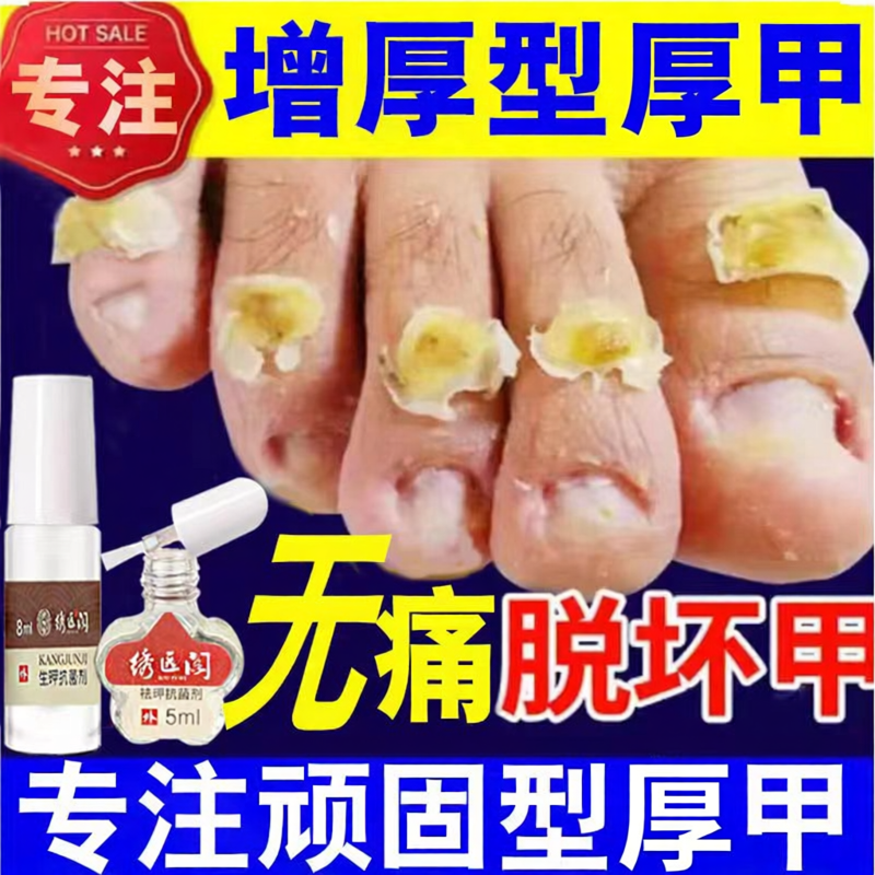 专注增厚灰甲专非用发黄分层灰甲生长液厚亮指甲变色软甲脱甲精油