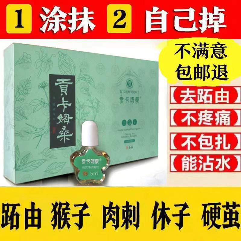 刘先生止忧净肉刺血胞去鱼休子膏除脚底刺猴老茧鸡茧膏贴手足跖忧