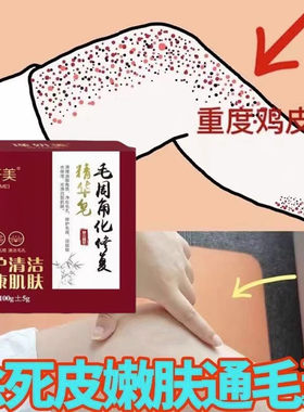 匠心制皂毛周角化修护精华皂去鱼皮手臂腿部全身鸡疙瘩官方正品