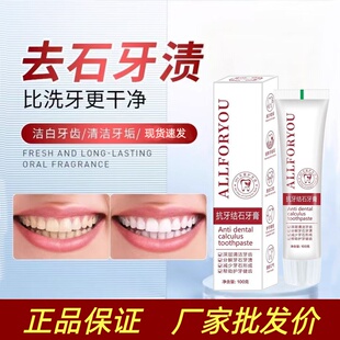 【爆款甄选】牙结石去除器美白去黄除口臭烟渍牙垢牙石溶解牙膏