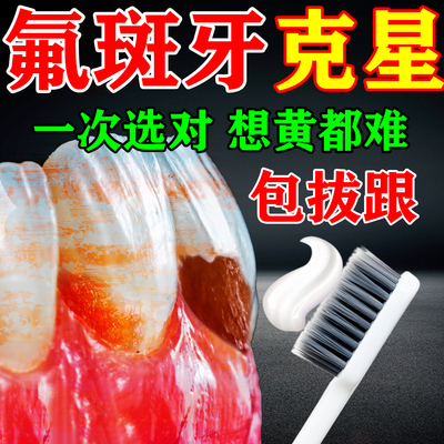 氟斑牙去除专用牙膏去牙垢黑牙渍牙菌斑黄牙速效清除牙齿美白神器